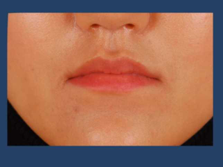 Illustration for article titled New Plastic Surgery Trend
